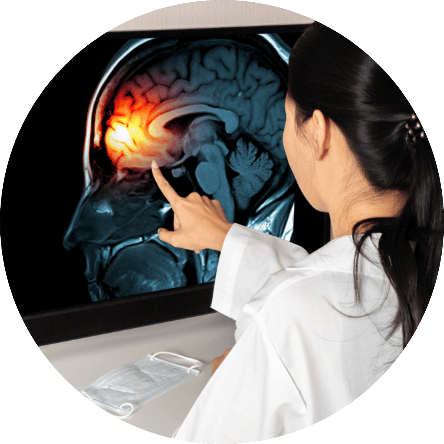doctor looking at a brain injury