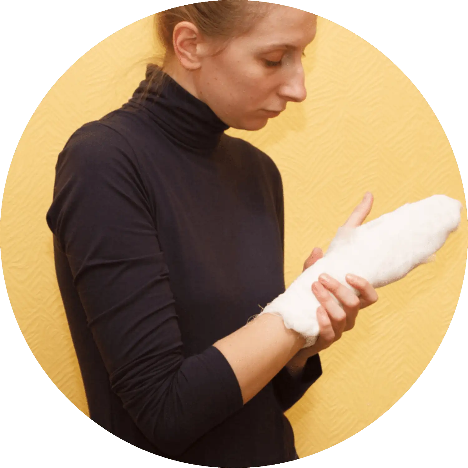 New York Burn Injury Lawyer